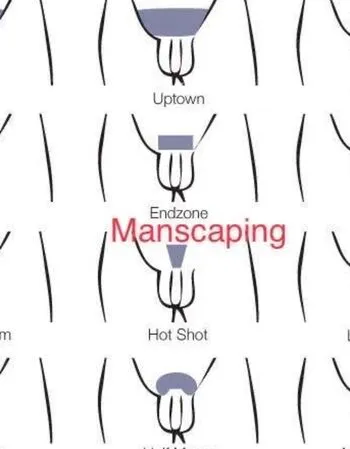 View Laser Hair Removal, Auckland Escort | Tel: 021 135 3725
